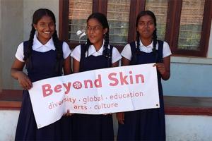 Beyond Skin working with school children | NICRC